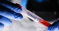 Rappel consignes DGS : Test RT-PCR SARS COV2 chez les professionnels de santé